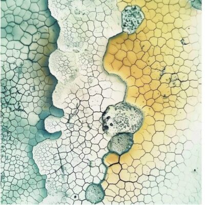 awhiworldai_79826_Can_you_make_some_microscopic_images_of_a_r_601a06b2-6e0a-4bbd-bbe0-7e5ac2831bc1_1 awhiworldai_79826_Can_you_make_some_microscopic_images_of_a_r_601a06b2-6e0a-4bbd-bbe0-7e5ac2831bc1_1